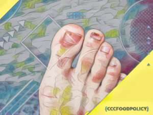 tratamentul ciupercii picioarelor și unghiilor