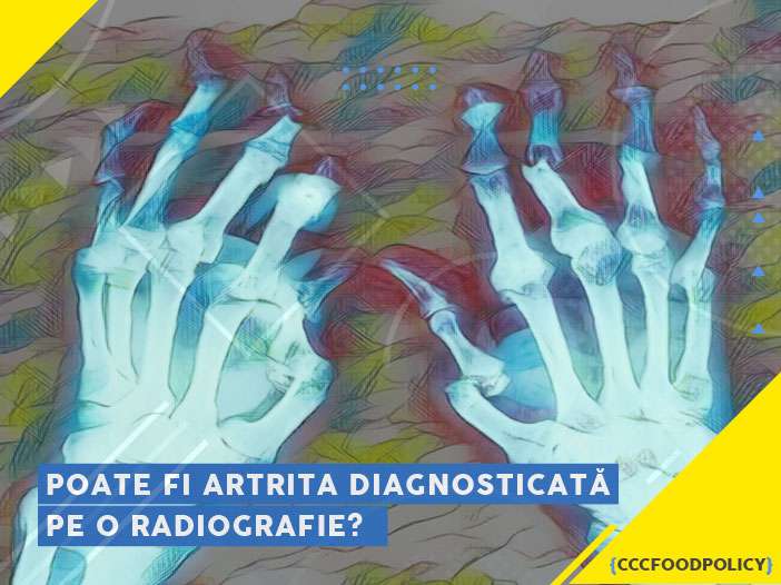 artrita radiografie